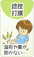捻挫　打撲